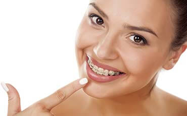 colocação de aparelho ortodonticos e estéticos em serafina correa é na Dalmagro Odontologia